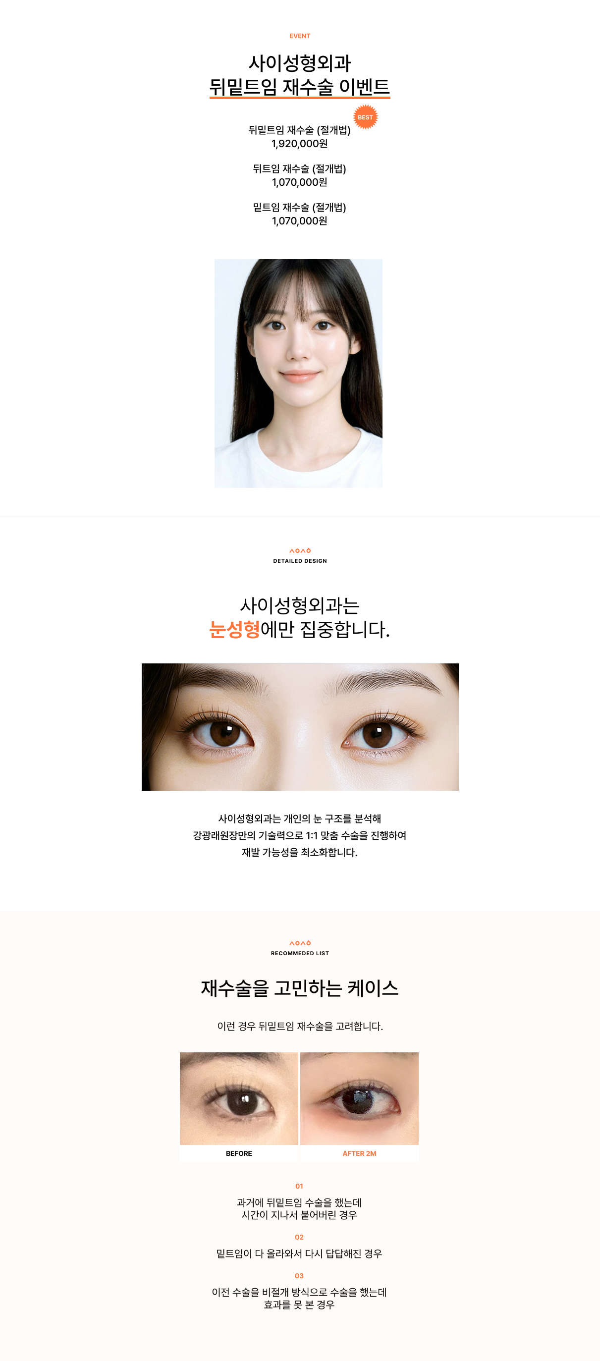 사이성형외과 이벤트 상세페이지