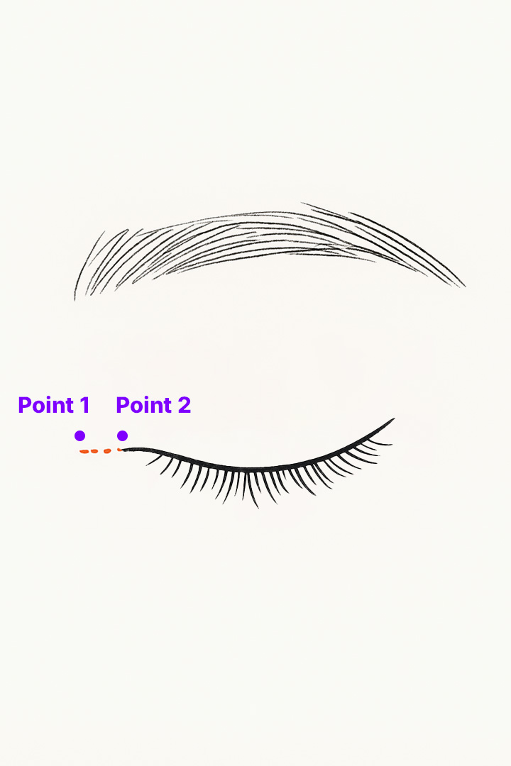 눈 앞쪽을 절개합니다.